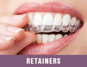 customized retainers for best repositioning
