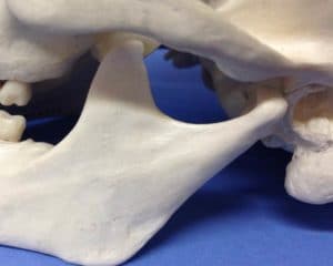 TMJ or temporomandibular joint