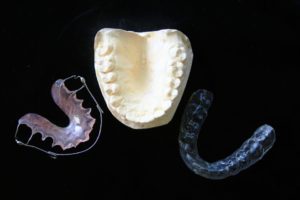 Orthodontic retainer, why