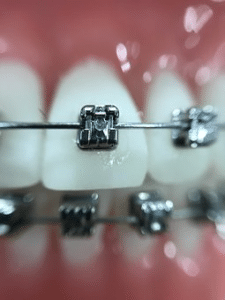 Why shall I visit my orthodontist