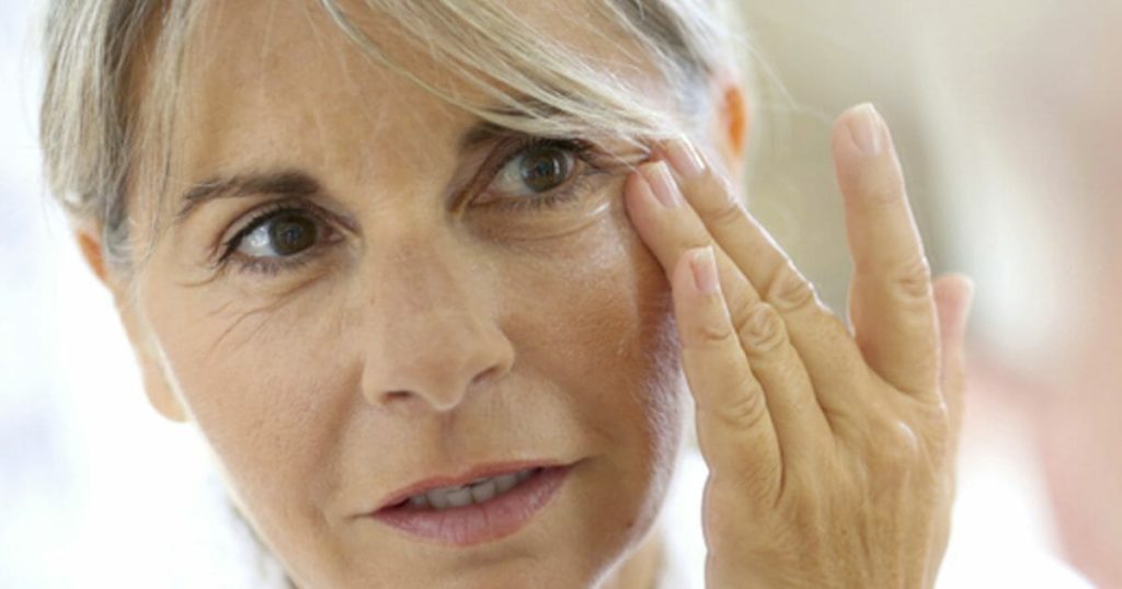 Aging Face - Botox Treatment