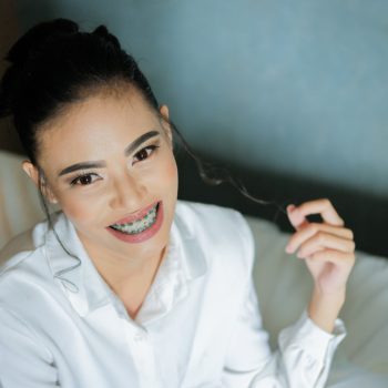 How Long You Should Wear Retainer