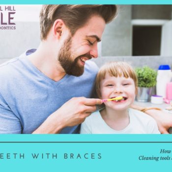 cleaning kids’ teeth with braces