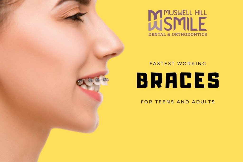 braces work the fastest for teens and adults