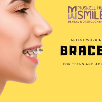 braces work the fastest for teens and adults