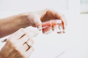 Dental-implants-for-multiple-missing-teeth